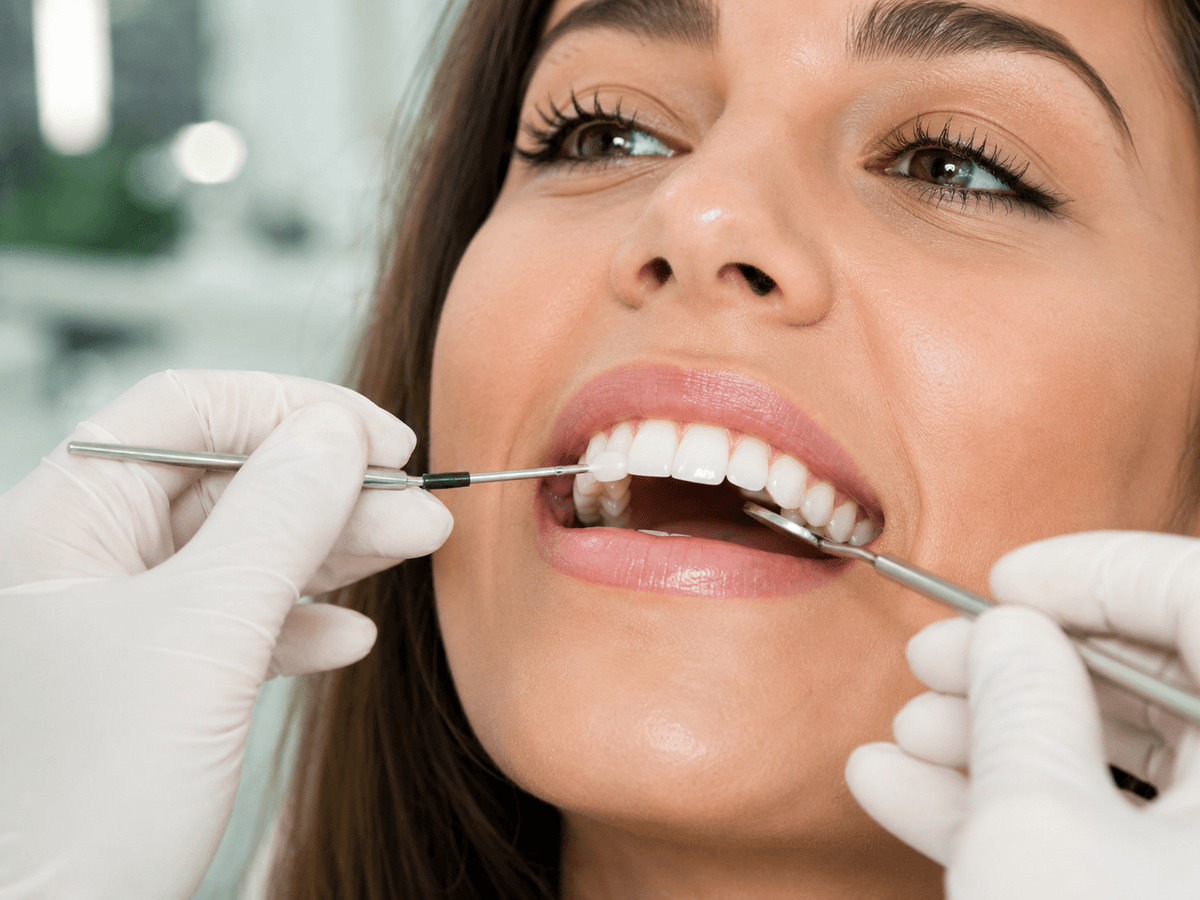 Composite Bonding